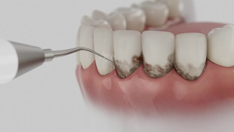 Trusted Emergency Dentist service in Laguna Hills, CA - Dentist Open Now